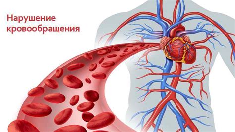 Нарушение кровообращения в голове