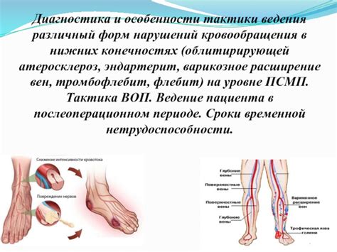 Нарушение кровообращения в нижних конечностях