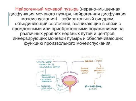 Нарушения мышц мочевого пузыря