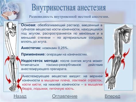 Недостаток местной покрытости: