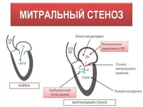 Недостаточное снабжение крови