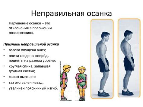 Неправильная осанка и неподходящая обувь