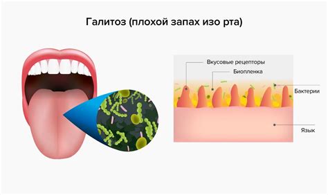 Неприятный запах изо рта и рыба: почему они связаны?