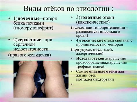 Нервное сжатие и отеки