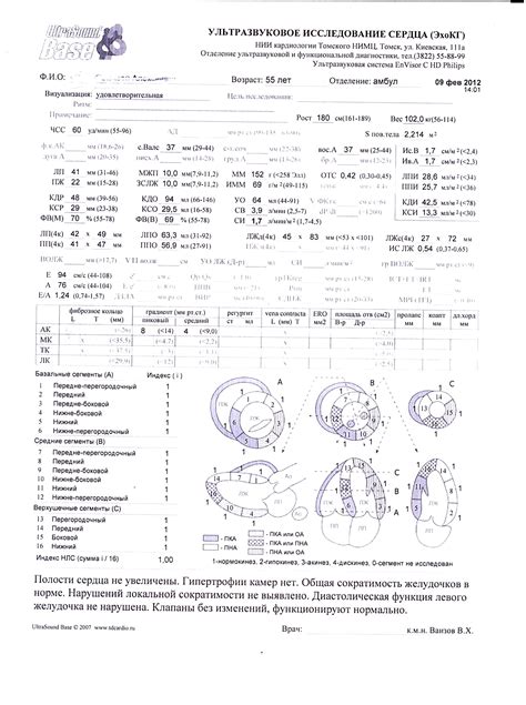 Несоответствие протоколам