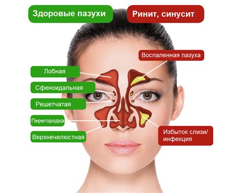 Ночной зноб: что это и как он проявляется