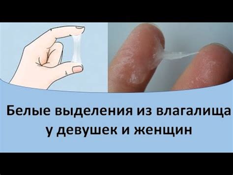 Обычные причины выделения слизи у девушек