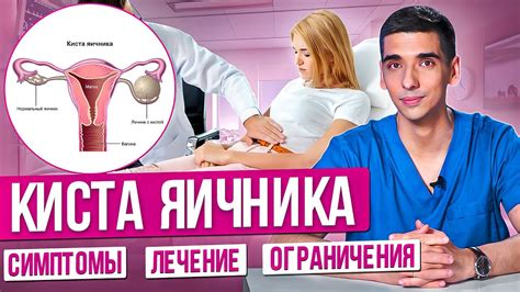 Ограничения при кисте яичника