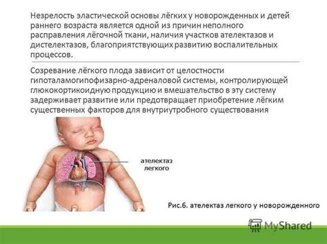 Одышка у ребенка: как определить причину