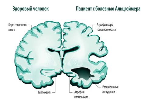 Ожирение и его влияние