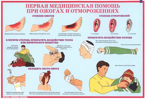 Ожоги: первая помощь и неотложная медицинская помощь при ожогах паром