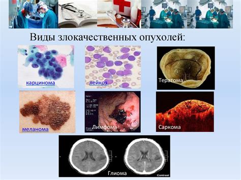 Онкологические заболевания: почему образуется кровотечение?