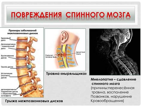 Опасность для позвоночника и спинного мозга