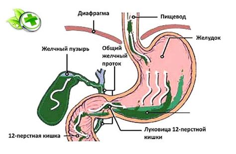 Основные причины и факторы формирования выброса желчи во время сна