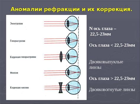 Ошибки рефракции и их влияние