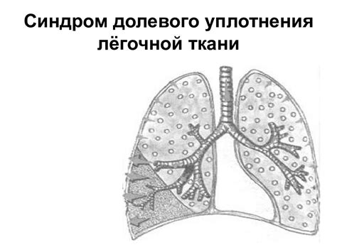 Патологии дыхательной системы