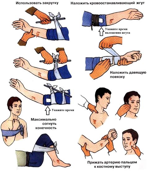 Первая помощь при кровотечении
