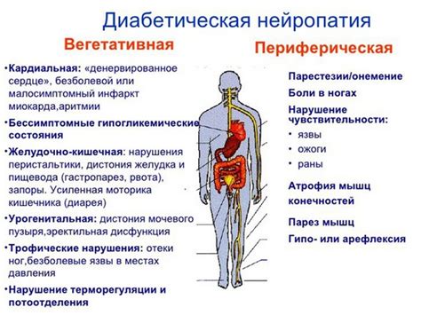 Периферическая нейропатия и диабетическая полинейропатия