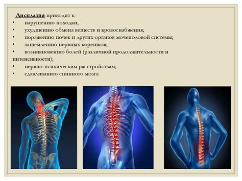 Повреждение позвоночника