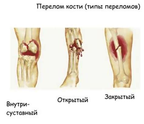 Повреждения и травмы переносицы