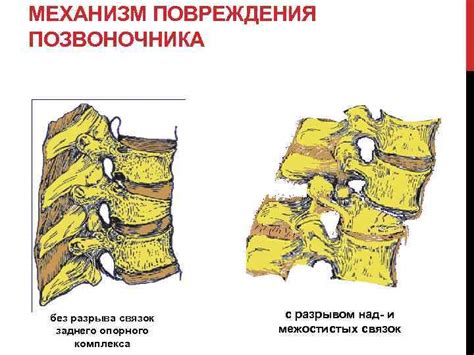 Повреждения позвоночника