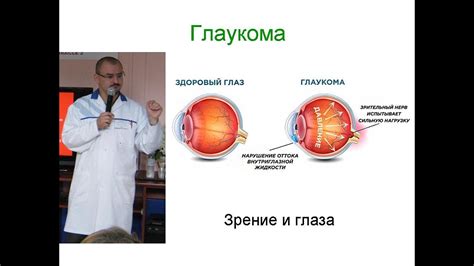 Повышение внутриглазного давления