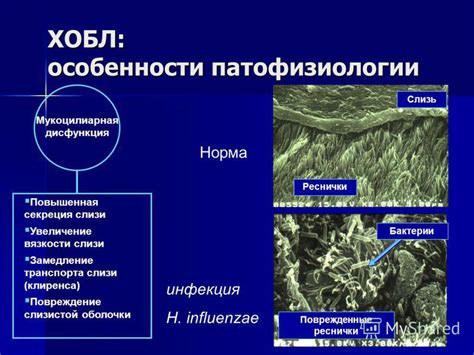 Повышенная секреция слизи