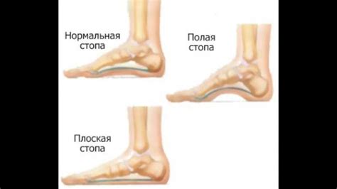 Подъем стопы: основные принципы