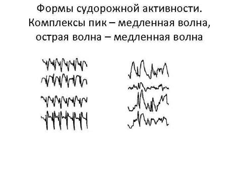 Показатели судорожной активности шейных мышц