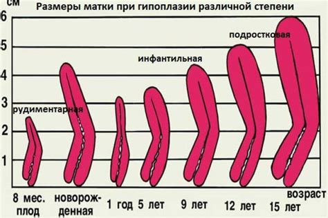 Половое отличие во вращении сосиски