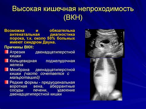 Потеря атмосферности и непроходимость обновлений