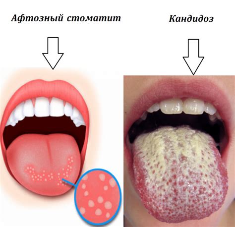 Почему возникает немота языка и губ, и головокружение?