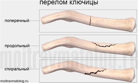 Почему кожа не срастается?