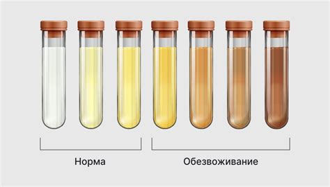 Почему моча подростков может быть некачественной?