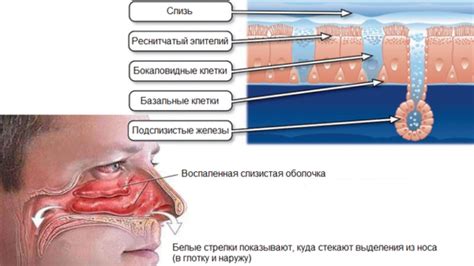 Почему сопли хлюпают?