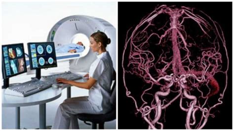 Преимущества ангиографии головного мозга