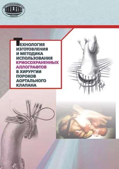 Преимущества использования металла в хирургии