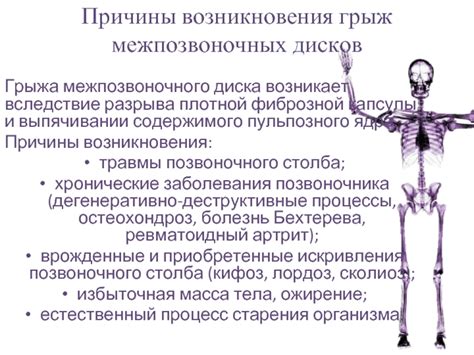 Причины возникновения разрыва: