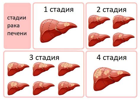 Причины горькой печени