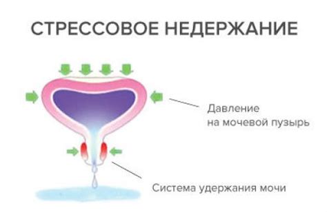 Причины повышенного давления на мочевой пузырь во время полового акта