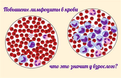 Причины повышенного уровня лимфоцитов 57 у женщины