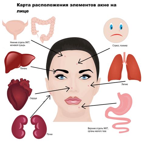 Причины появления прыщей