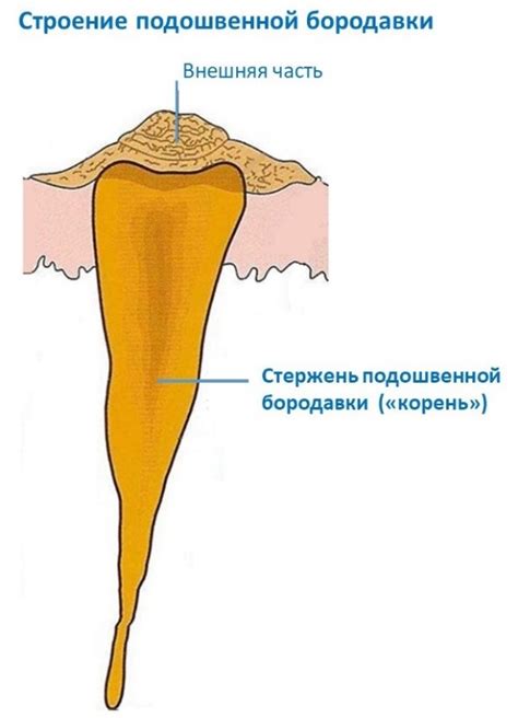 Причины появления шипицы