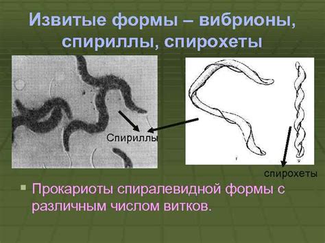 Причины спиралевидной формы