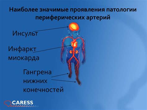 Проблемы, вызванные нарушением иммунитета