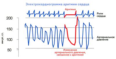 Проблемы с датчиками и датчиками сердечного ритма