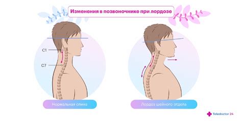 Разница между нормальным и патологическим трясением