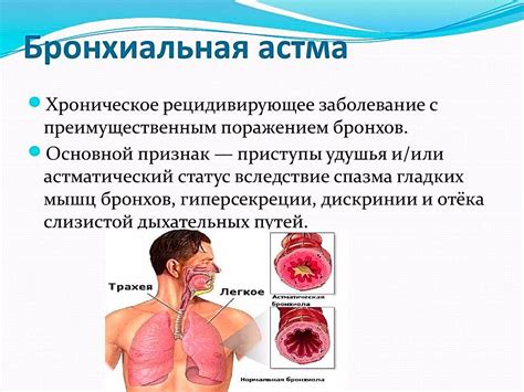 Раскрытие вреда м холиномиметиков при бронхиальной астме