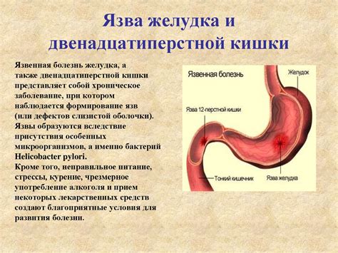 Расстройства пищеварительной системы