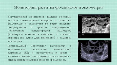 Риски и осложнения третьего этапа стимуляции яичников